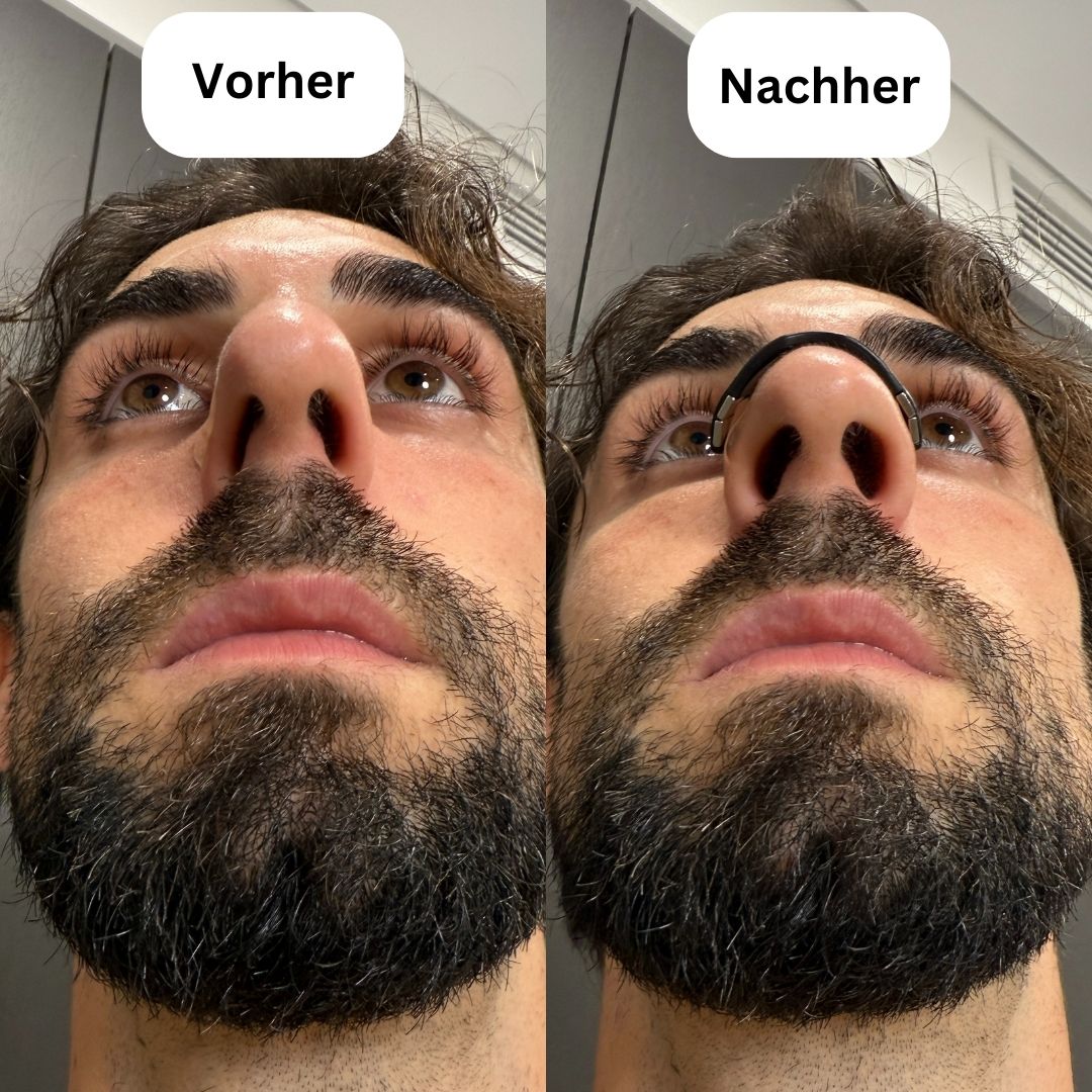NasenKraft™ Magnetische Nasenpflaster