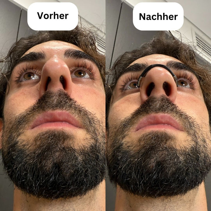 NasenKraft™ Magnetische Nasenpflaster
