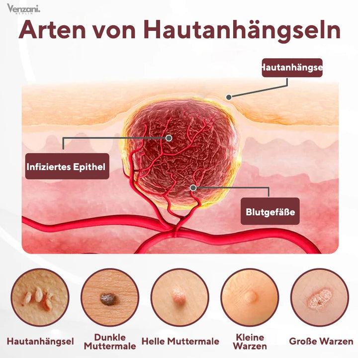 Cvreoz® KeraErase Dual-Action Erneuerungscreme - Die Kraft aus Schwarzem Reis gegen raue Stellen