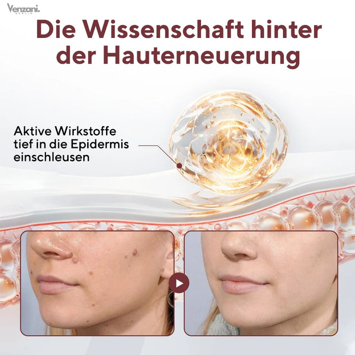 Cvreoz® KeraErase Dual-Action Erneuerungscreme - Die Kraft aus Schwarzem Reis gegen raue Stellen